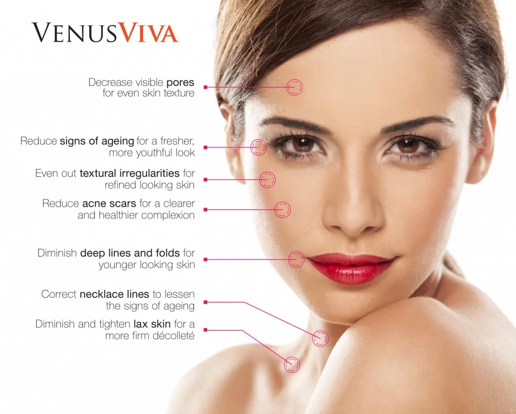 Venus Viva Applications